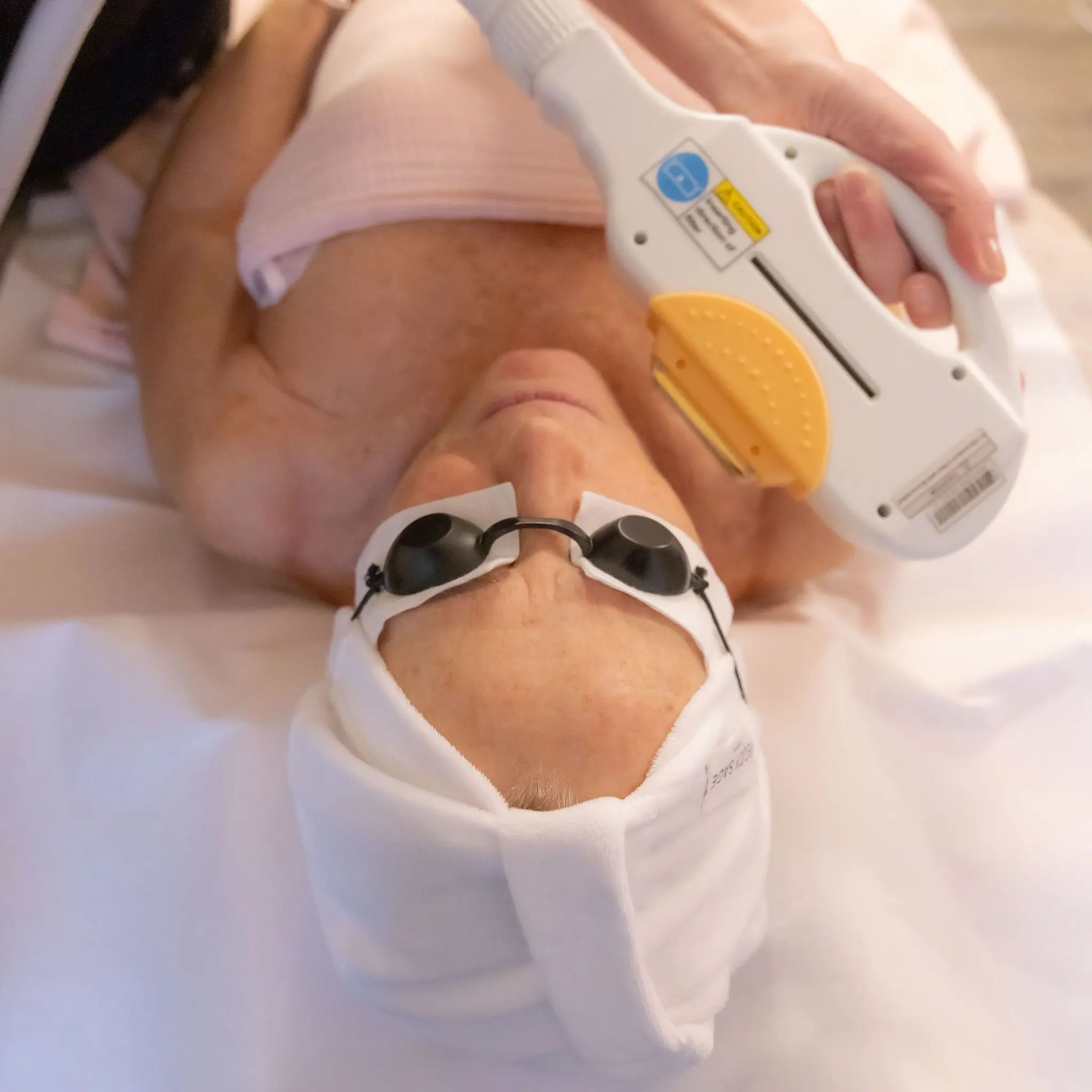 photorajeunissement HTA 